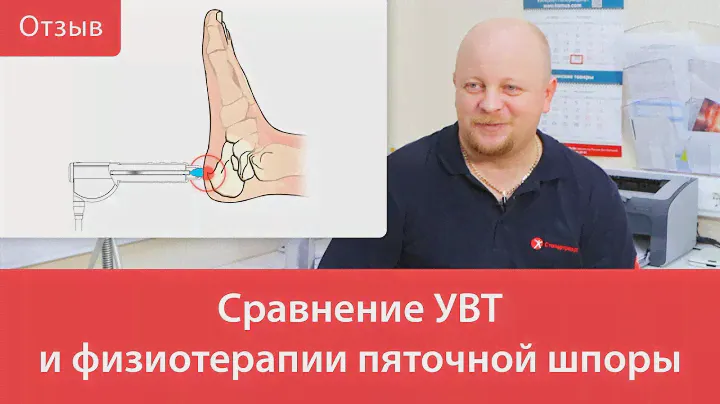 Сравнение УВТ и физиотерапии пяточной шпоры